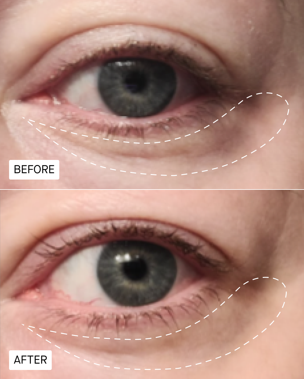 H30 Fibroquin™ Advanced Firming Eye Cream